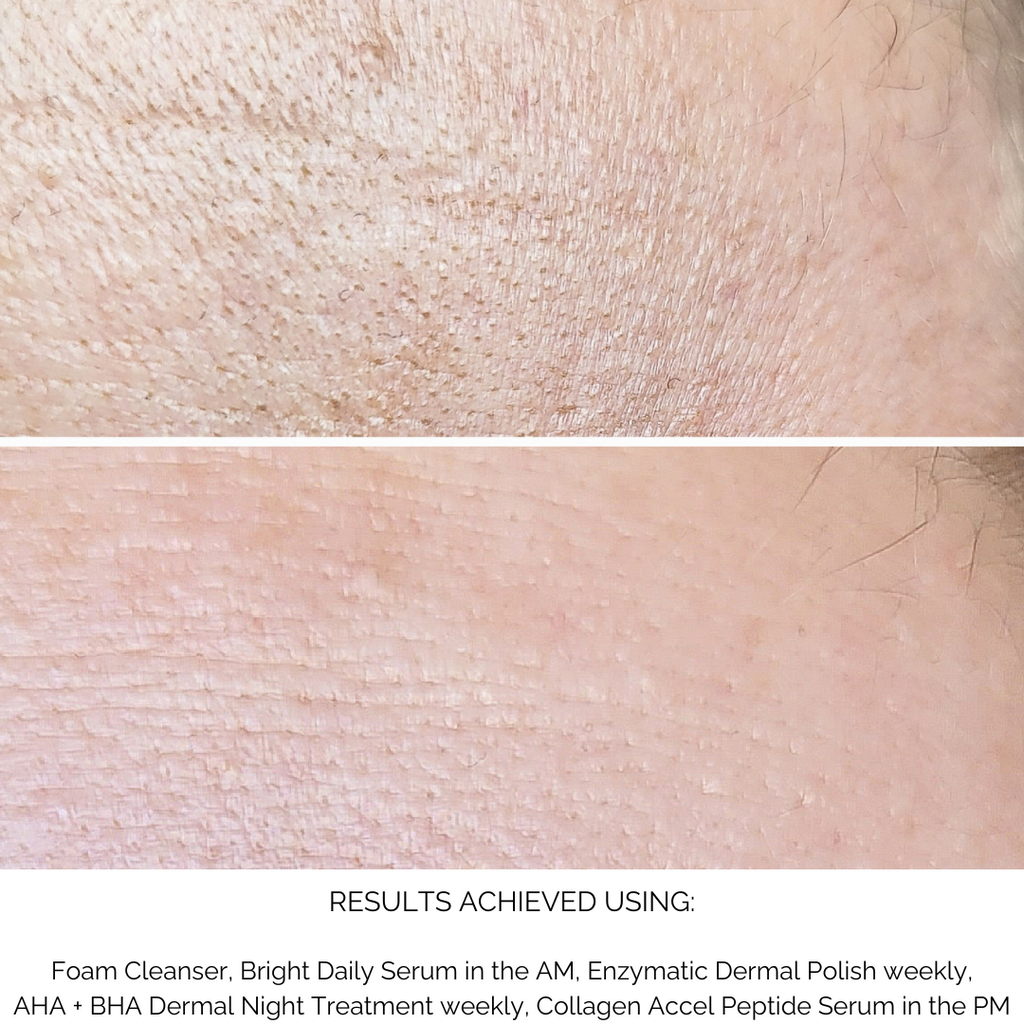 Bright Serum