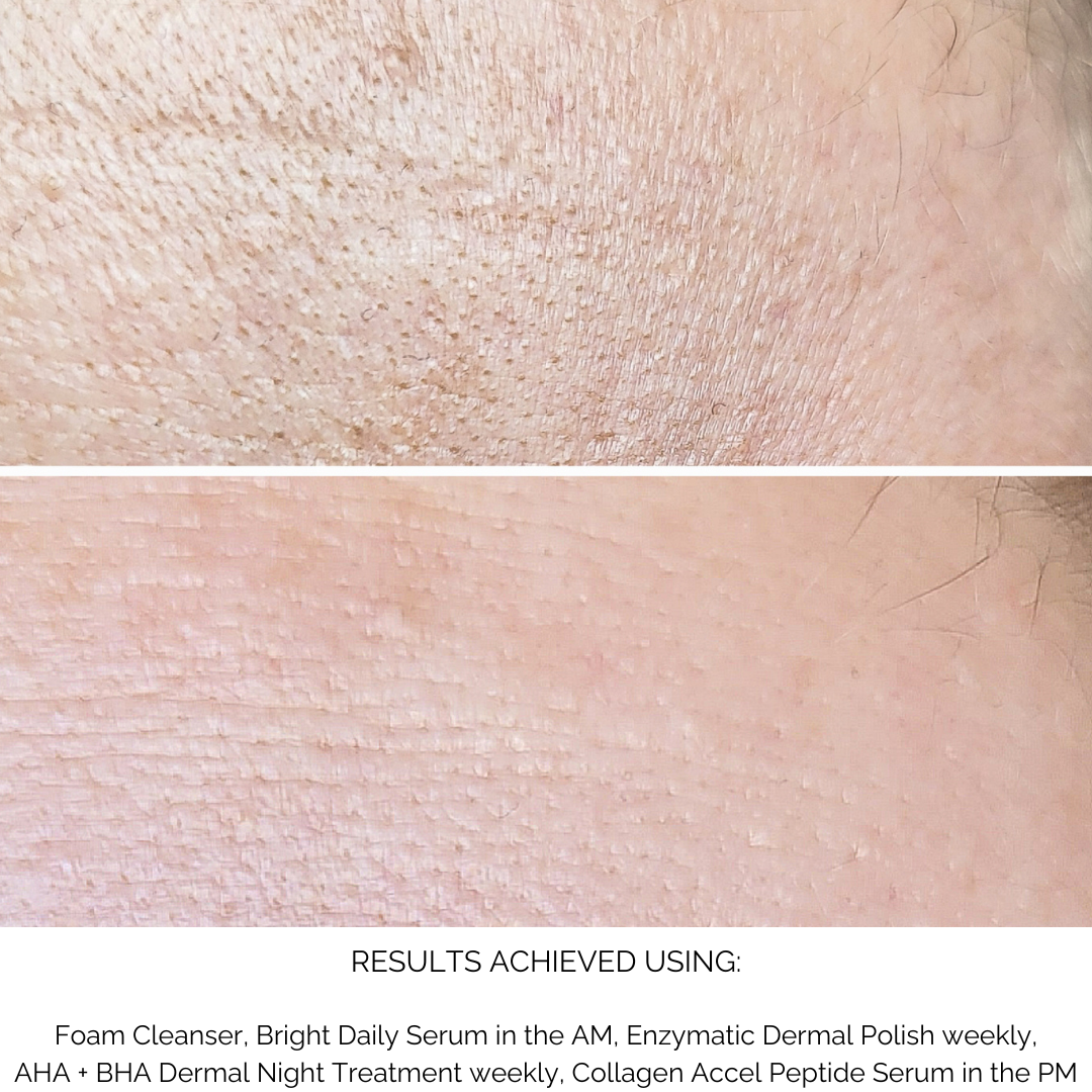 Bright Serum